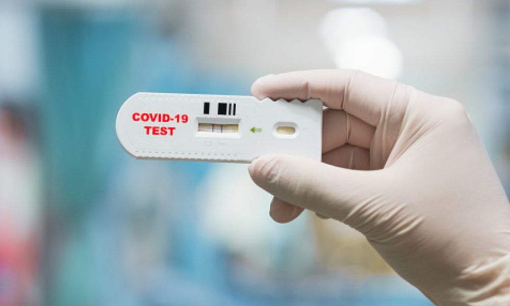 Secretaria de Saúde inicia realização de testes rápidos para covid-19 nesta quarta