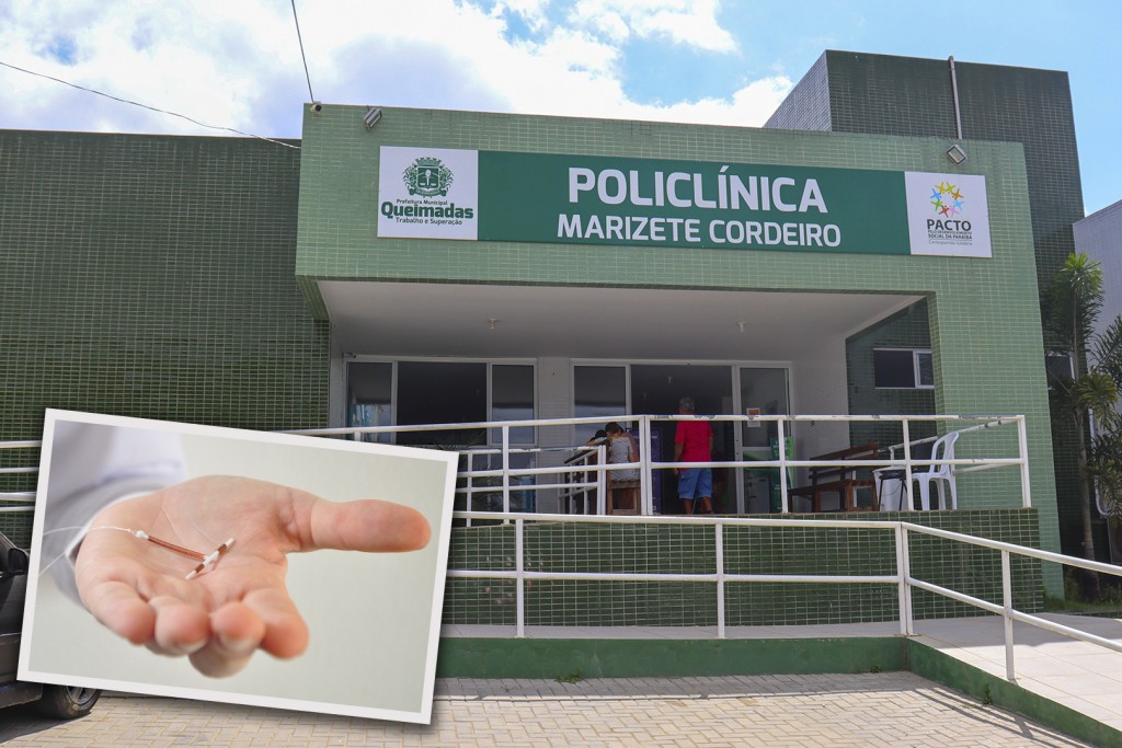 Secretaria de Saúde de Queimadas inicia o serviço de inserção gratuita de DIU para mulheres de Queimadas-PB